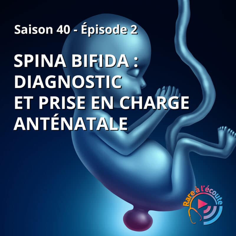 Spina bifida diagnostic et prise en charge anténatale