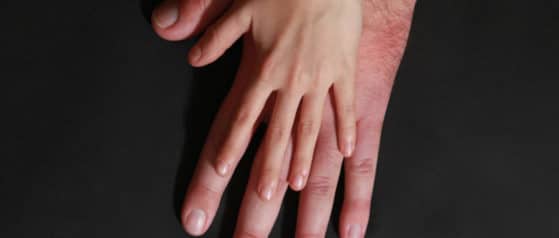 Acromégalie_Symptômes