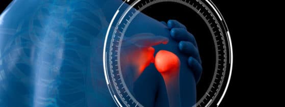 Acromégalie_Symptômes_Rhumatologie