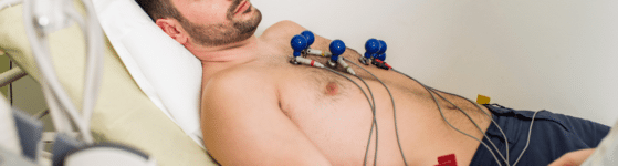 prise en charge amylose cardiaque - electrocardiogramme