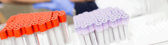 diagnostic HPN ou Hémoglobinurie Paroxystique Nocturne