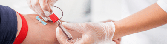 HPN ou Hémoglobinurie Paroxystique Nocturne