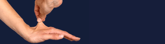 Syndromes d’Ehlers-Danlos Non Vasculaires (SED)