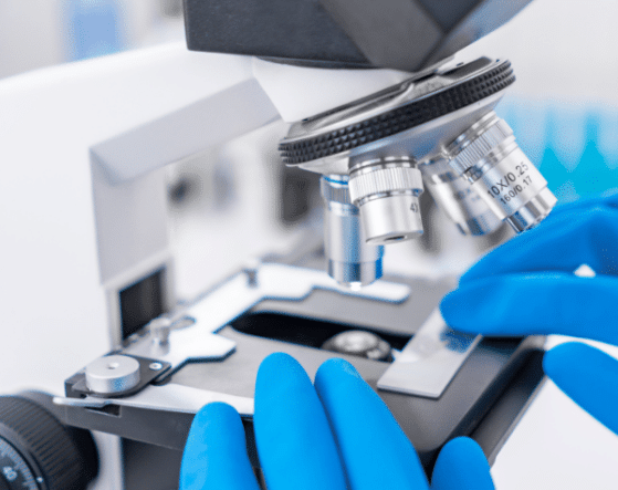 biopsie maladies vasculaires porto-sinusoïdales