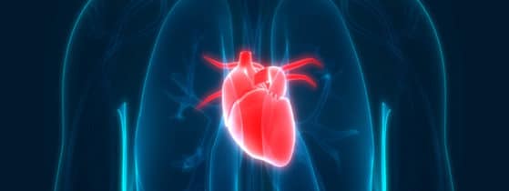 Syndrome GACI - Symptômes cardiaques