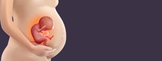 Syndrome GACI - Diagnostic