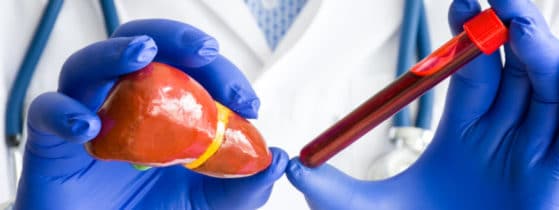 Maladie de Wilson - Bilan hépatique