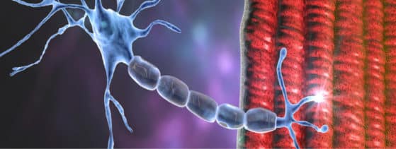 Myasthénie auto-immune - Définition