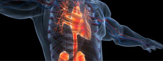 Maladie de Fabry - Phénotypes