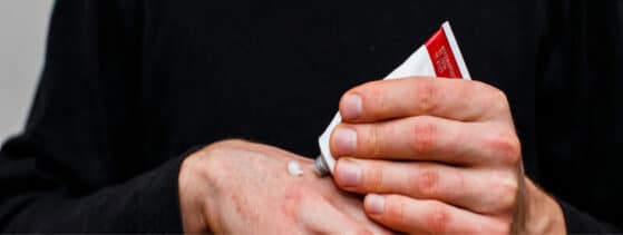 Psoriasis pustuleux généralisé - traitement local