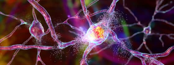 SLA - Démence frontotemporale