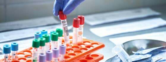 DAAT - Dosage sanguin