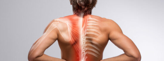 Syringomyélie - Description clinique