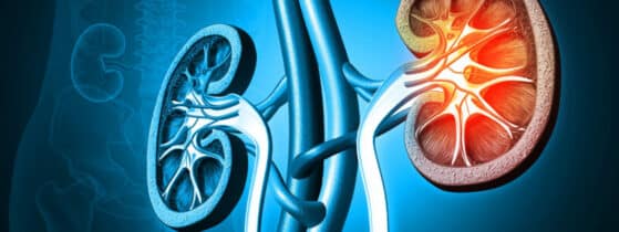 Les points clés – Définition de l’acidose tubulaire rénale distale