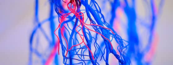 symptômes de la Vascularite à ANCA