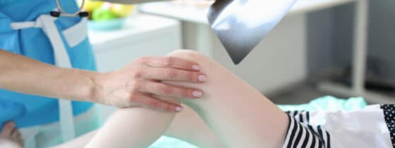 Diagnostic de la Dysplasie Fibreuse des Os (DFO)