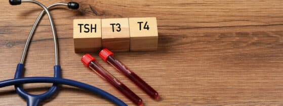 Diagnostic du déficit en MCT8