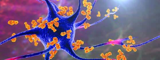 Définition de l’encéphalite auto-immune