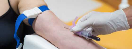 Diagnostic de la maladie de Pompe