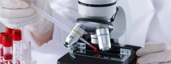 La prise en charge de la maladie de Willebrand