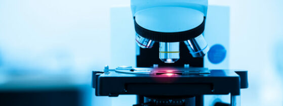 Diagnostic de l’artérite à cellules géantes