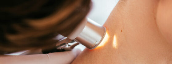 Les symptômes des mastocytoses