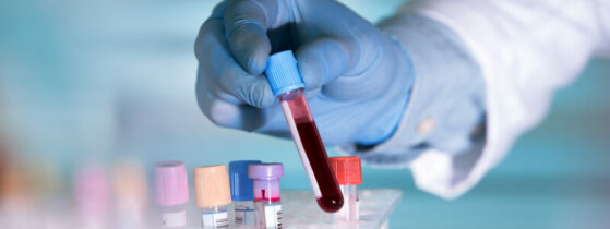 Diagnostic des mastocytoses