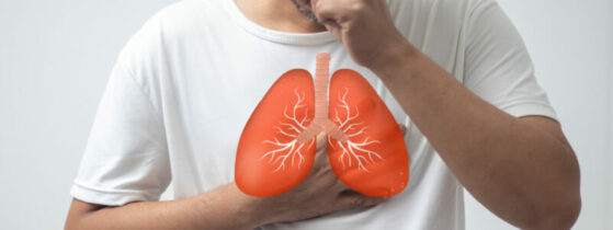 Maladie pulmonaire à mycobactéries non tuberculeuses