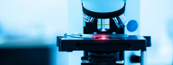 Diagnostic de la néphropathie à IgA