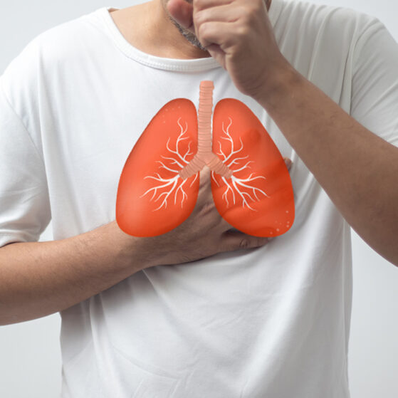 Maladies pulmonaires &agrave; mycobact&eacute;ries non tuberculeuses